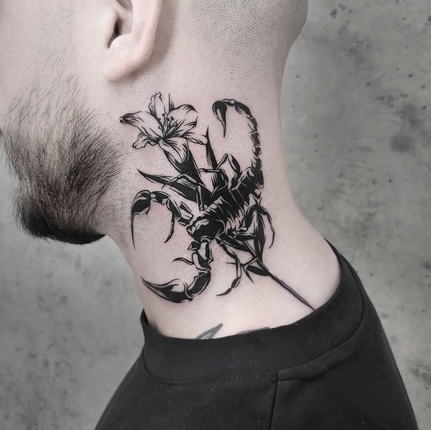 Guys with Scorpion Tattoos on His Neck and Stuff Oozes Oht | TikTok